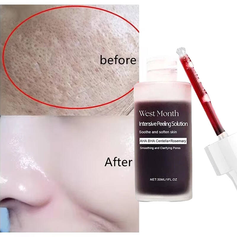 Tranexamic Acid Serum - Feels Like Silk, Looks Like Filter.
