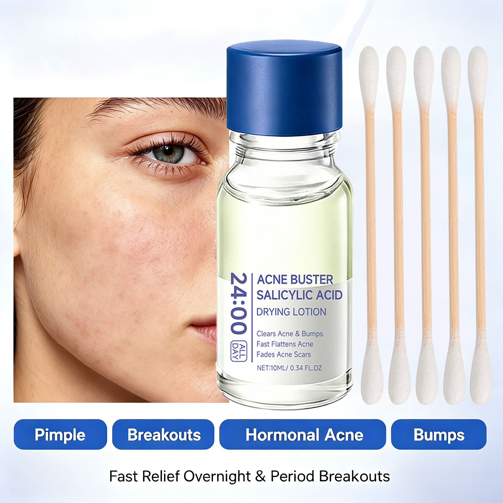 Tranexamic Acid Serum - Salicylic Acid Acne Treatment Serum Spot