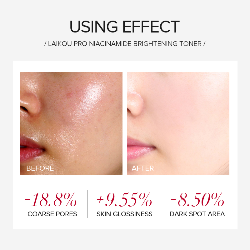 LAIKOU PRO Niacinamide 4Pcs Br - Skincare Oily Skin 评论和价格
