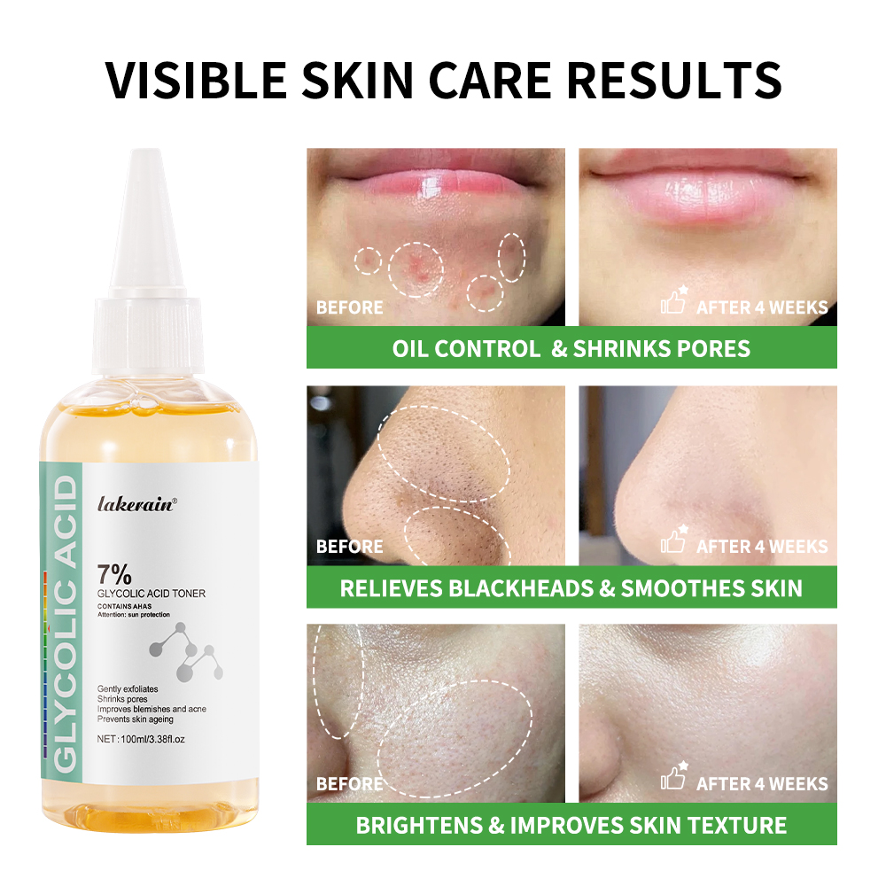 Glycolic Acid 7% Toning Soluti - Lactic Acid Toner 评论和价格