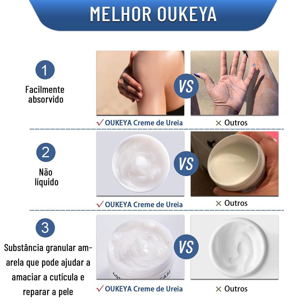 Urea Cream 40% Moisturizing An - Urea Foot Cream 评论和价格