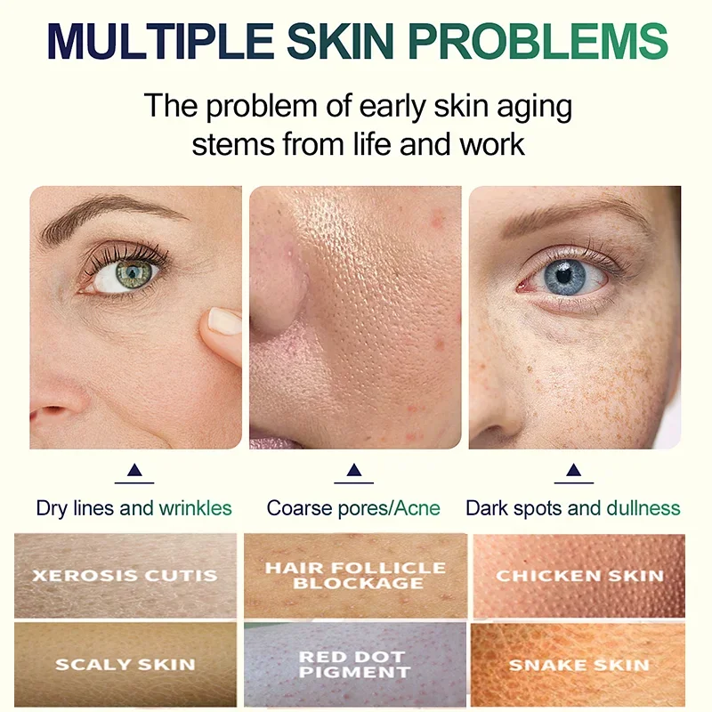 2ND Salicylic Acid Face Facial - Tranexamic Acid Serum 评论和价格