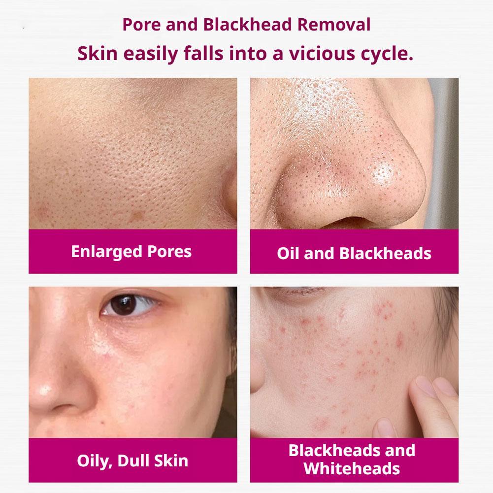 Salicylic Acid Shrink Pores Se - Tranexamic Acid Serum 评论和价格