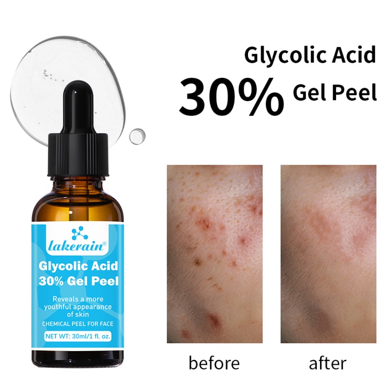 30% Glycolic Acid Peel Gel Pro - Lactic Acid Toner 评论和价格