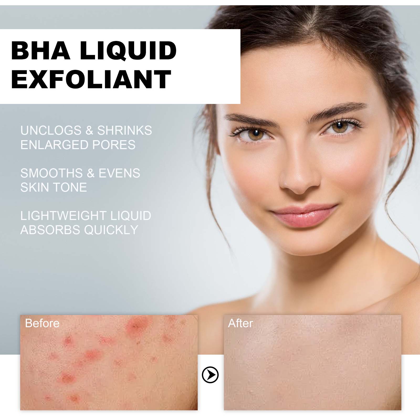 2% Salicylic Acid Liquid Exfol - Tranexamic Acid Serum 评论和价格