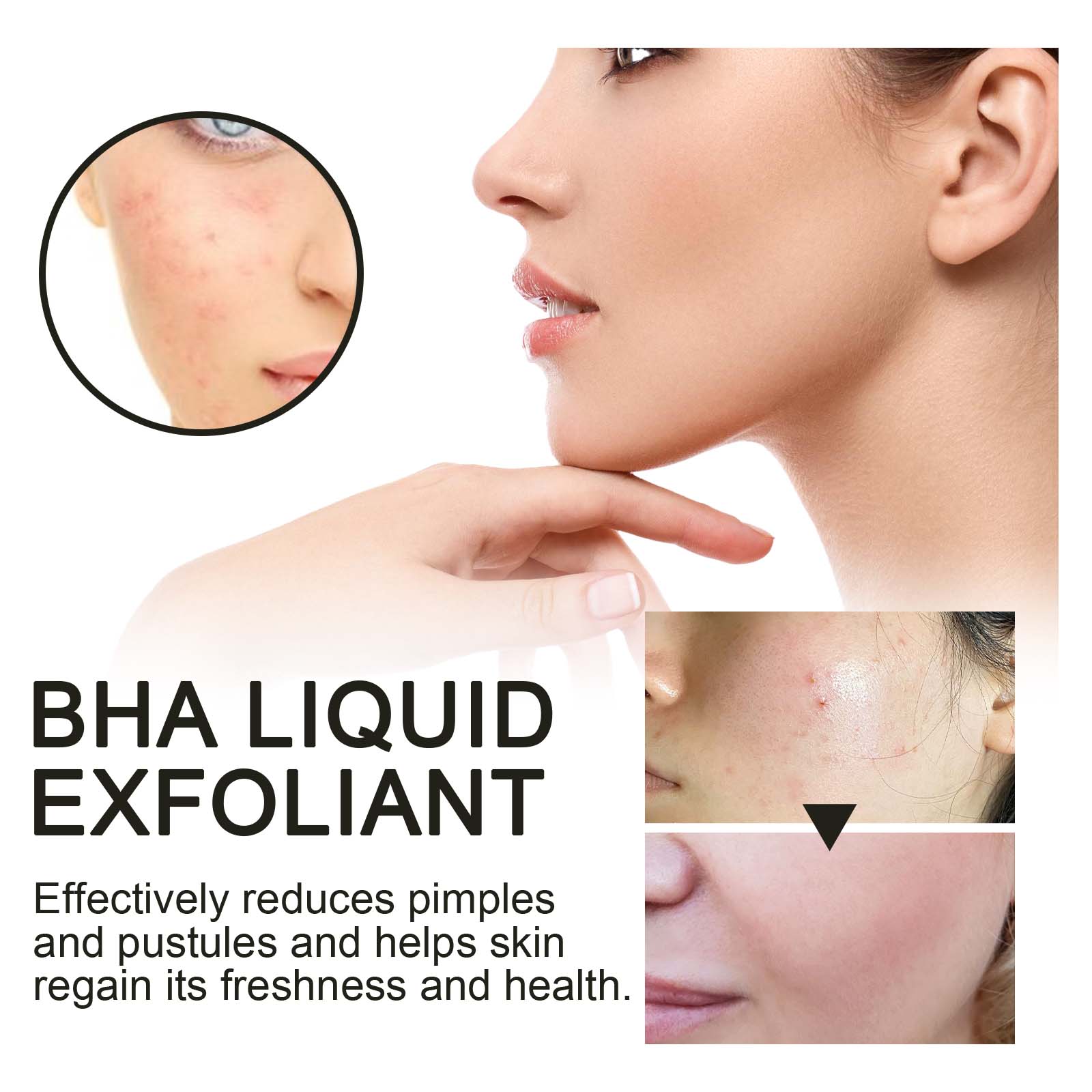 2% Salicylic Acid Liquid Exfol - Tranexamic Acid Serum 评论和价格