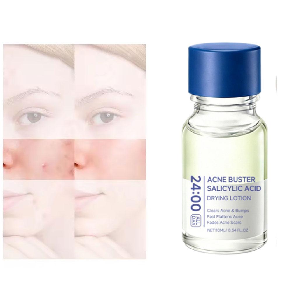 Salicylic Acid Essence Treatme - Tranexamic Acid Serum 评论和价格