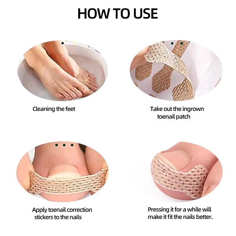 10-100Pcs Adhesive Toenail Pat - Skincare Oily Skin 评论和价格