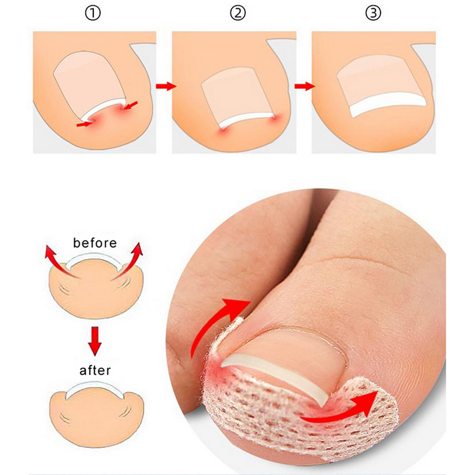 10-100Pcs Adhesive Toenail Pat - Skincare Oily Skin 评论和价格