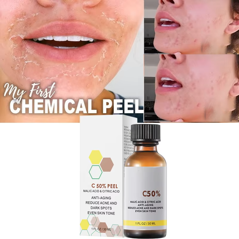 With Malic Acid And Citric Aci - Tranexamic Acid Serum 评论和价格