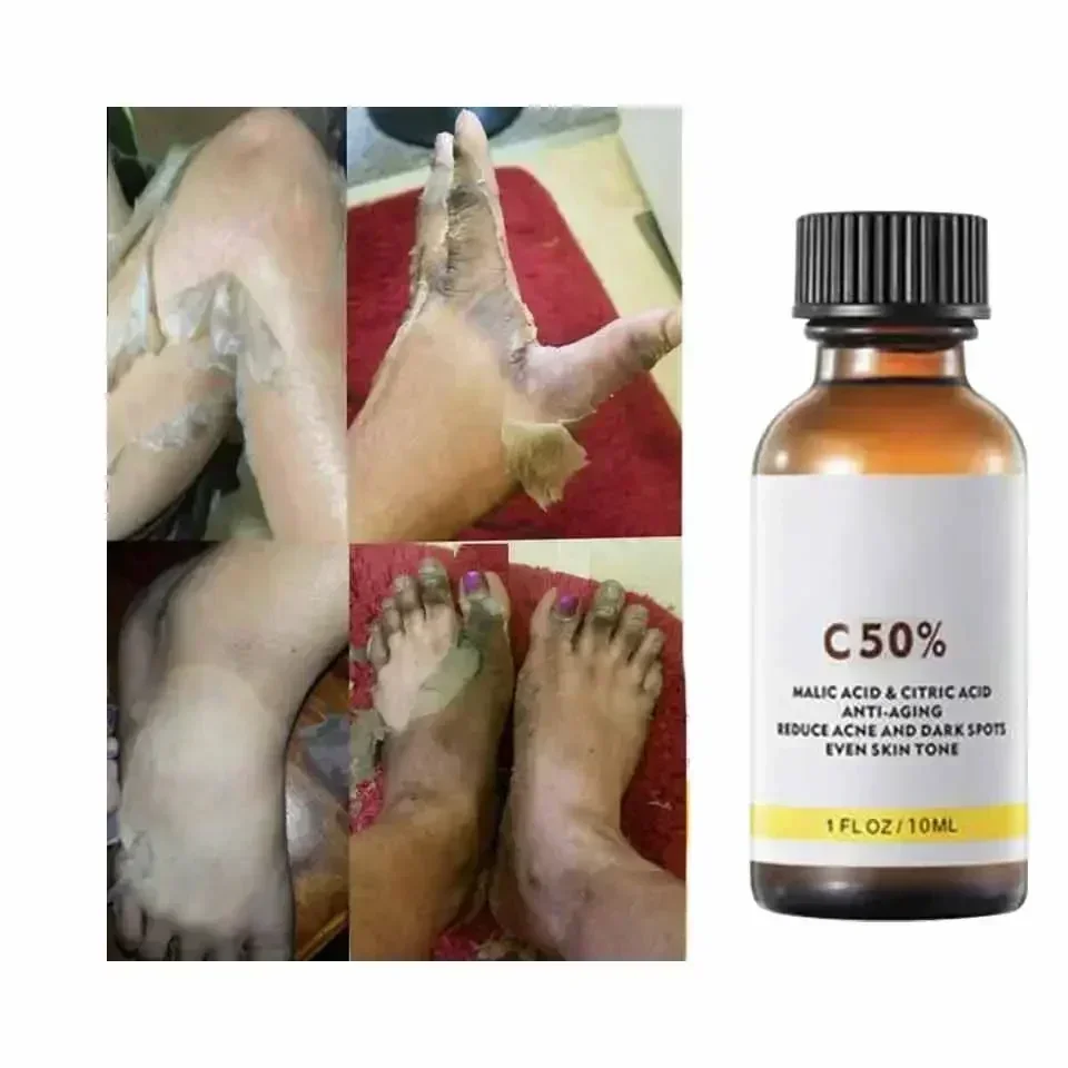 With Malic Acid And Citric Aci - Tranexamic Acid Serum 评论和价格