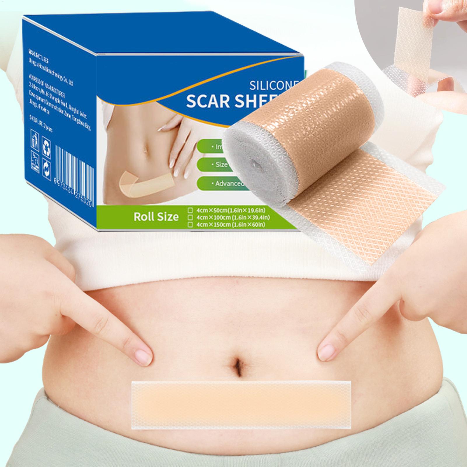 1 Roll Silicone Scar Sheets 4c - Skincare Collagen 评论和价格